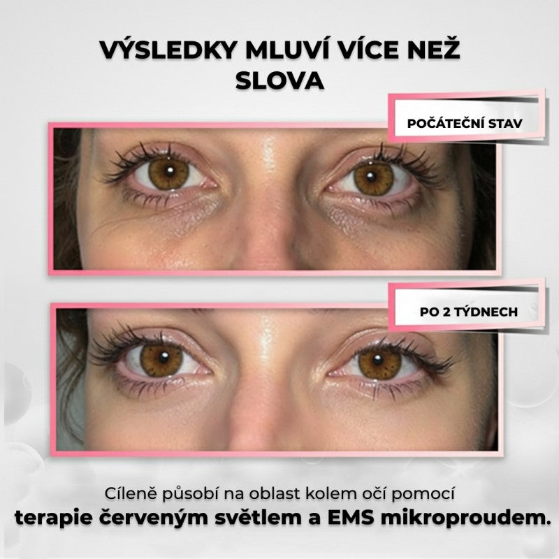 LumoEye 2v1 terapie červeným světlem + EMS pro oční okolí