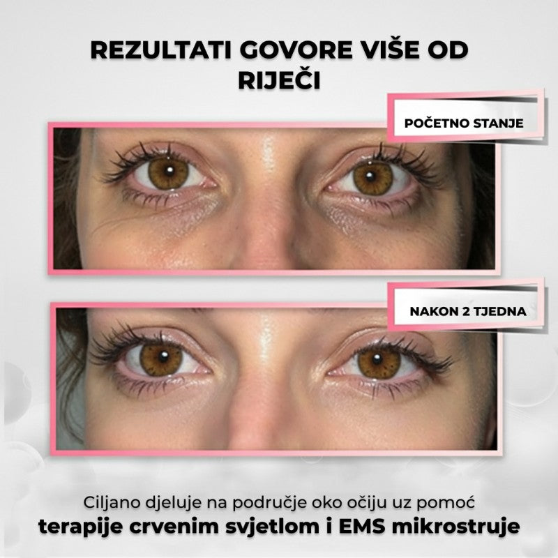 Lumo 2-u-1 terapija crvenim svjetlom + EMS za područje oko očiju